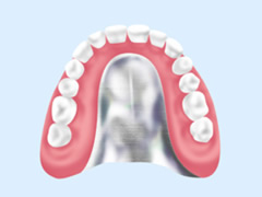 コバルトクロム床義歯 画像