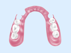 ノンクラスプデンチャー　画像