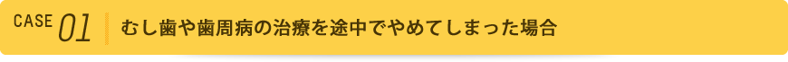 むし歯や歯周病の治療を途中でやめてしまった場合