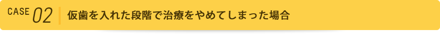 仮歯を入れた段階で治療をやめてしまった場合