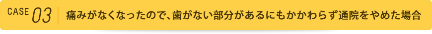 痛みがなくなったので、歯がない部分があるにもかかわらず通院をやめた場合